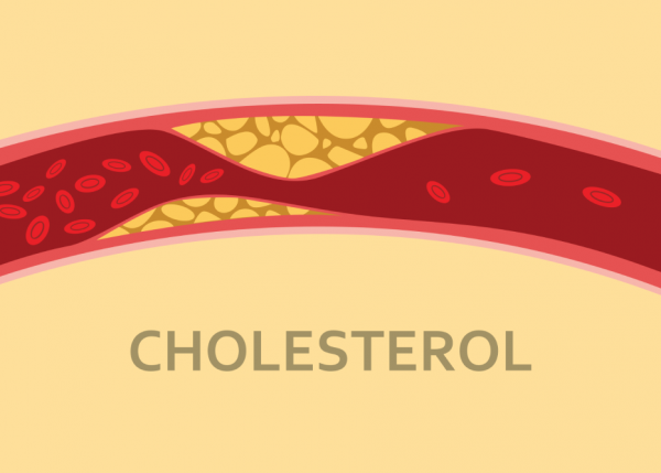 کاهش کلسترول بالا و فشار خون با آب گوجه فرنگی و سیر