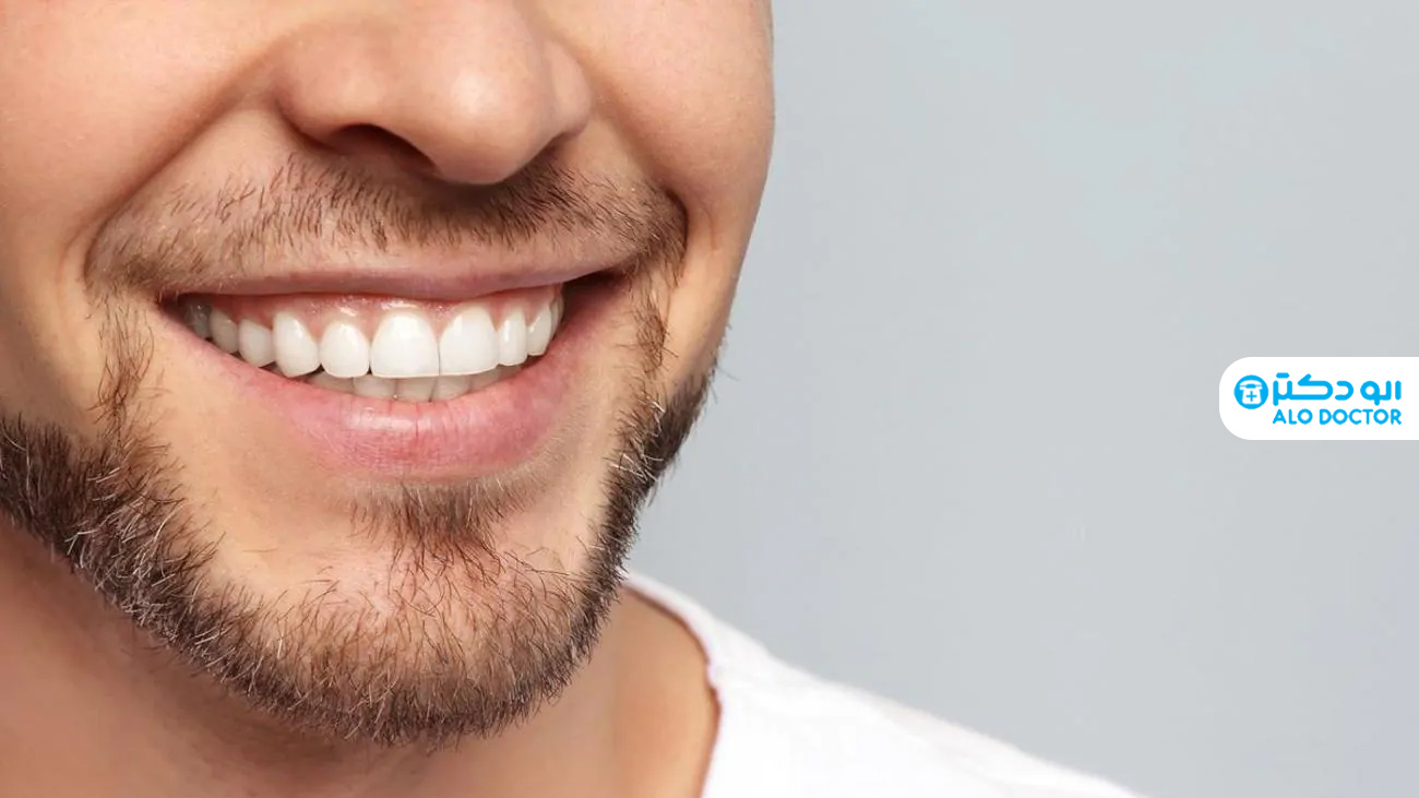 سفید کردن دندان ها با ساده ترین روش های خانگی