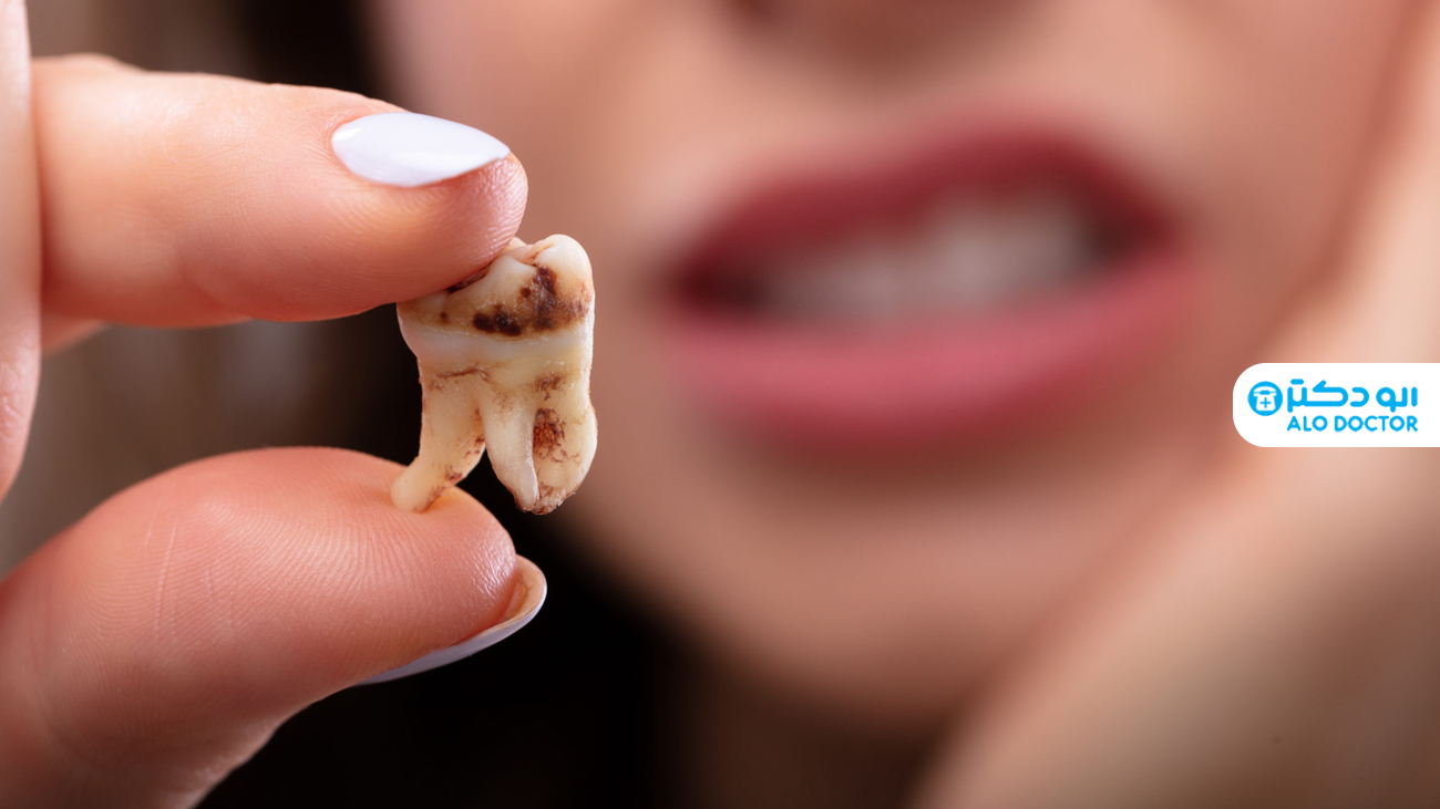 چگونه دندان هایی سالم و محکم داشته باشیم؟