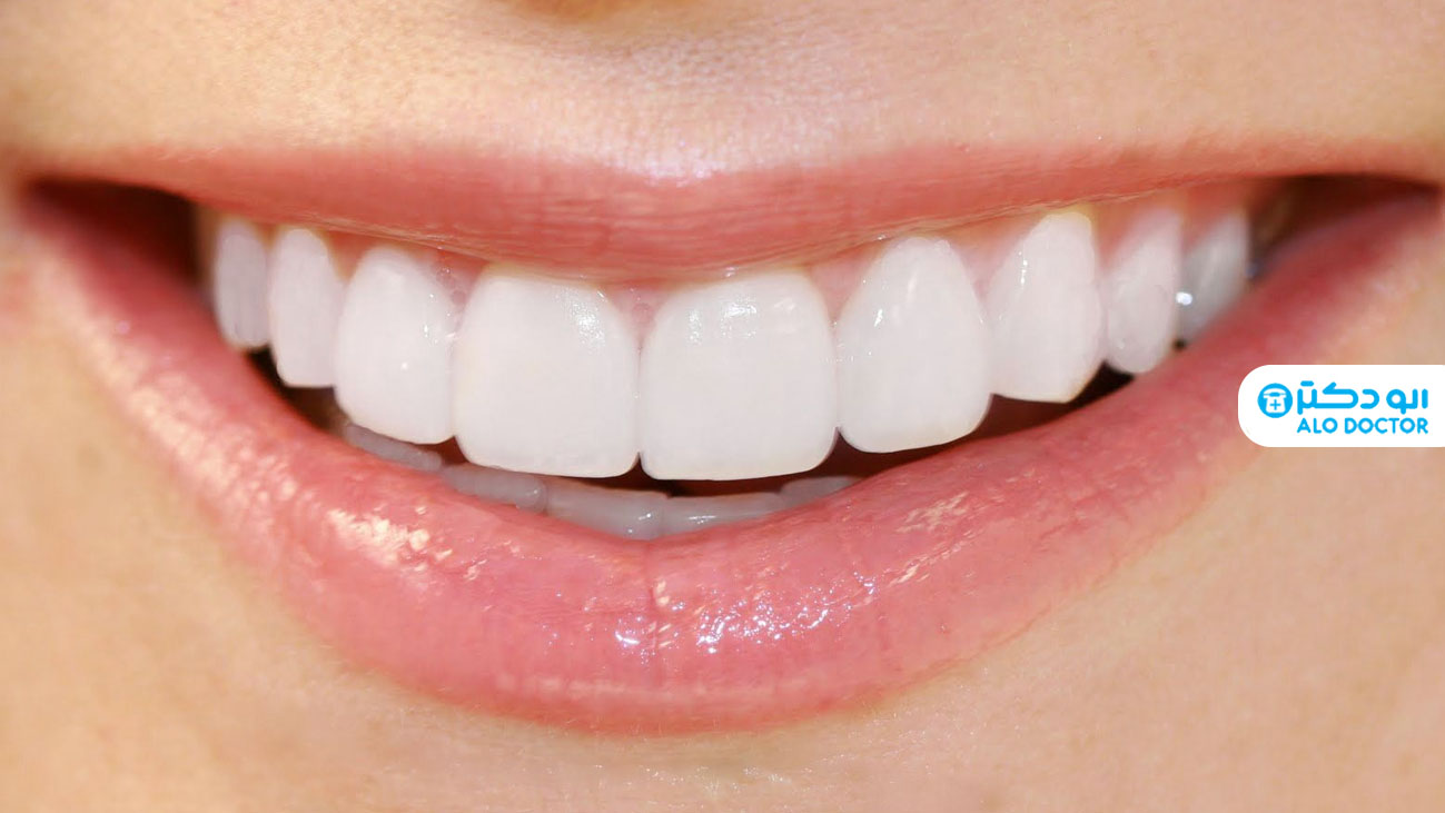 با انواع لمینیت دندان آشنا شوید