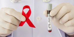 راهنمای خواندن برگه آزمایش ایدز