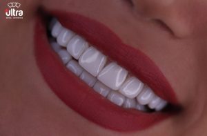 دندانپزشکی تخصصی الترادنتال ( ارائه دهنده انواع خدمات درمانی، ترمیمی و زیبایی)