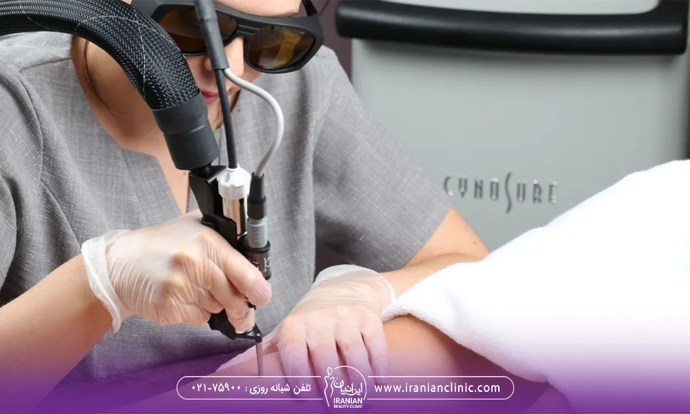تکنسین لیزر در حال لیزر موهای پای مراجعه کننده با لیرز سایناشور