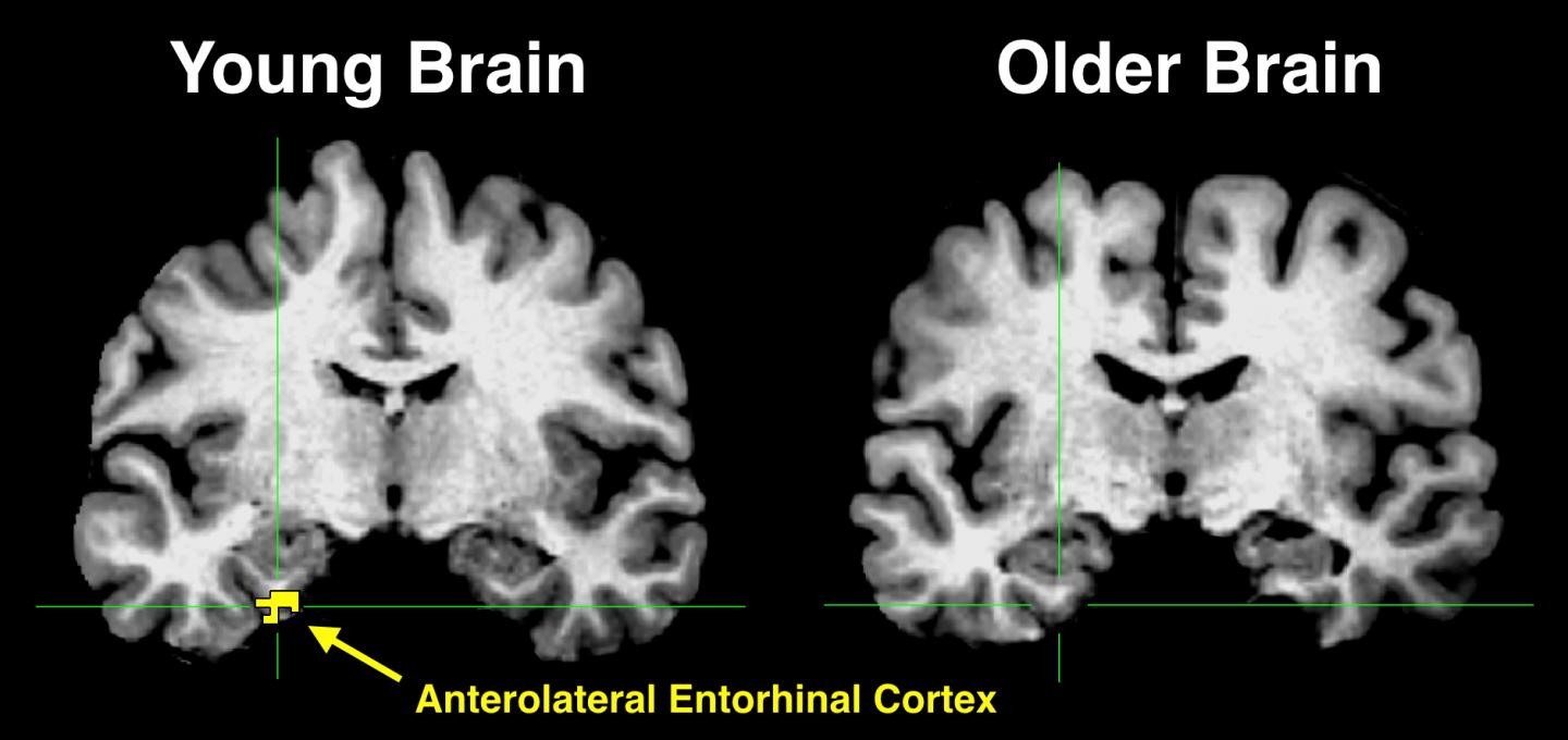 چرا برخی دچار پیری زودرس مغز می شوند؟