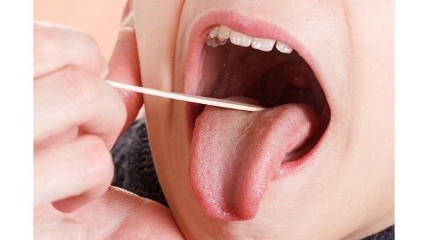 کبودی زبان خطرناک است؟