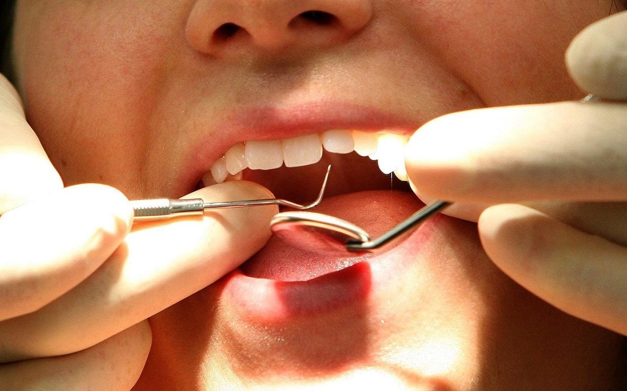 چگونه تغذیه سالم، موجب سلامت دهان و دندان می شود؟