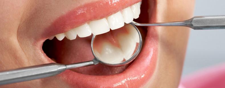 چند توصیه کلیدی برای مراقبت از دندان‌ها