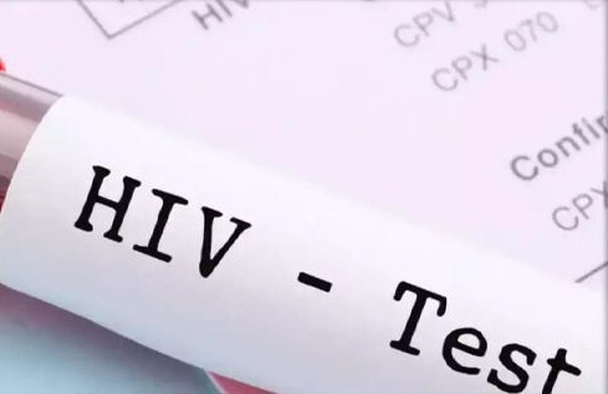 علائم ایدز یا HIV را بدانید