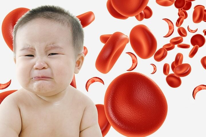 درباره کم خونی کودکان بیشتر بدانیم