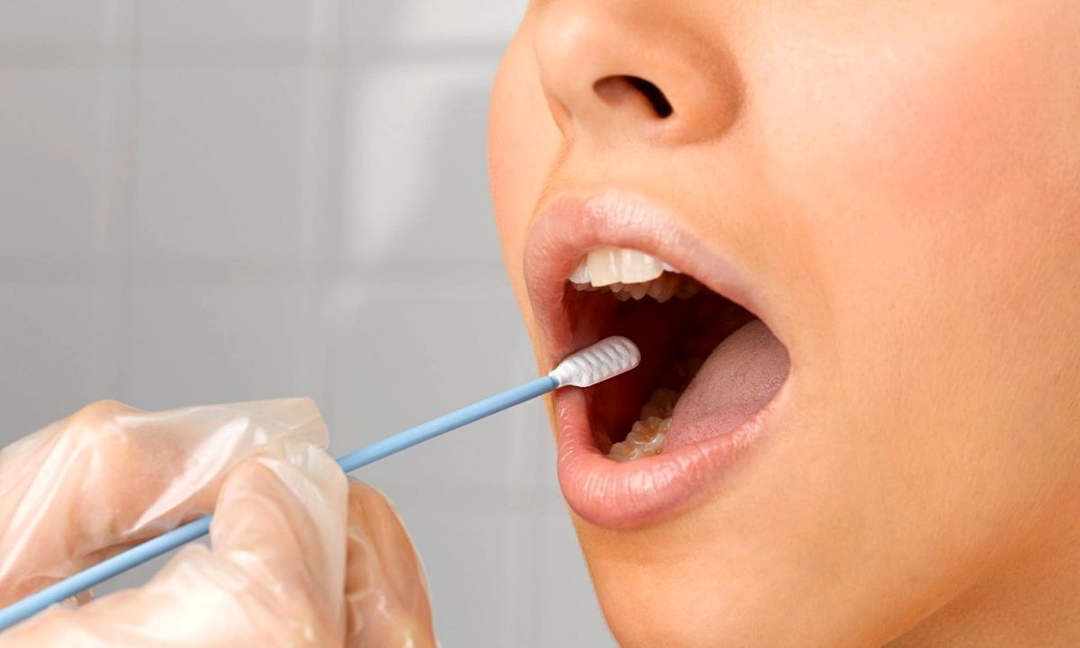 تشخیص سرطان معده با شست و شوی دهان در مطب پزشک