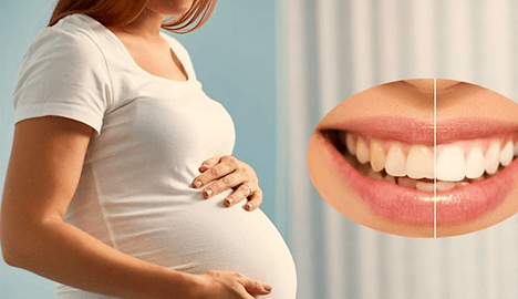 سلامت دهان و دندان را در دوران بارداری این گونه تقویت کنید
