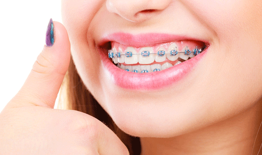 فواید شگفت انگیز ارتودنسی